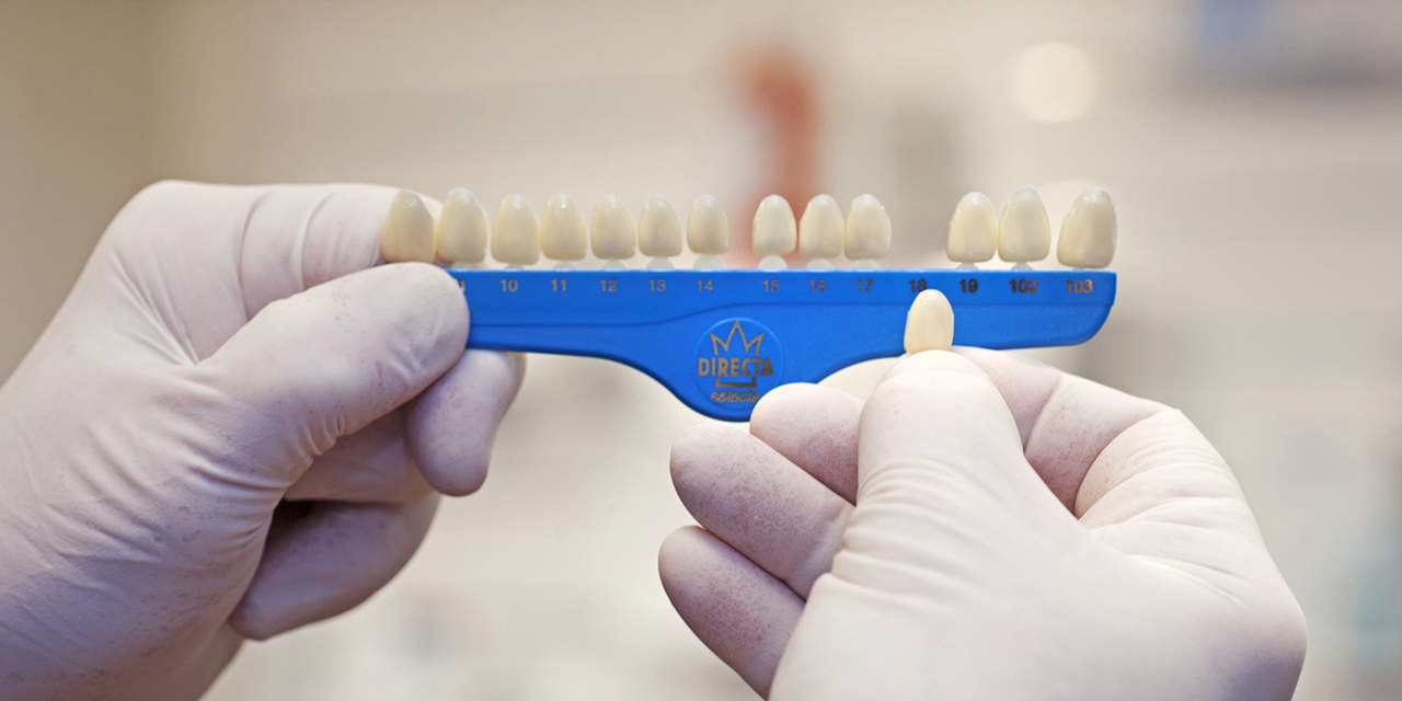 Directa plastkroner 16 609307