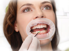 Optragate small hvid 590851 