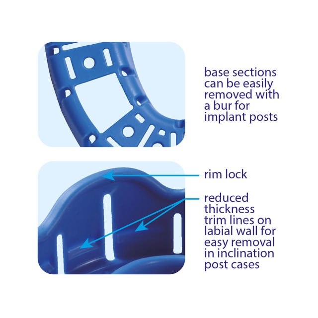 Premium aftryksske ass. 410