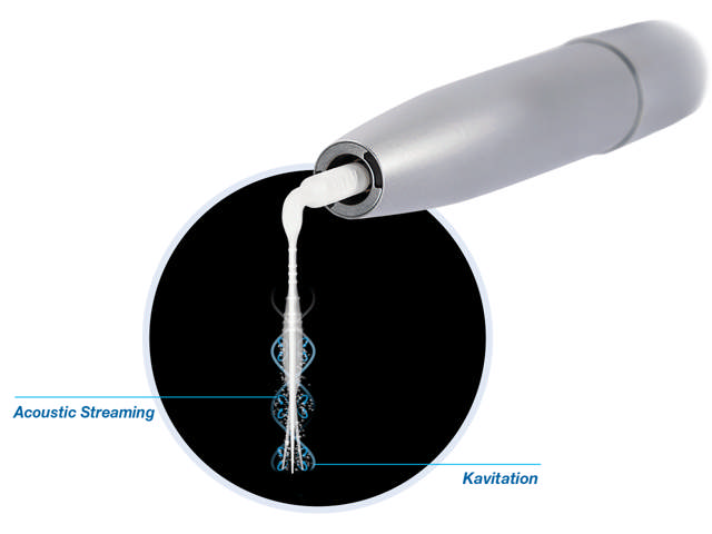 VDW Eddy Irrigation tips V041441