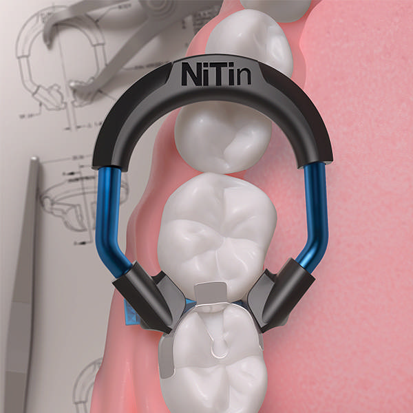 NiTin ring lang molar sort NT400